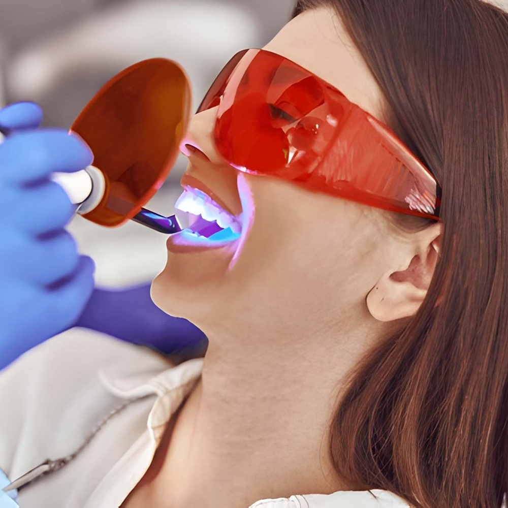 تبييض الأسنان